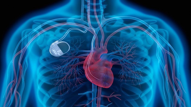 pacemaker doctor in ghaziabad, east delhi